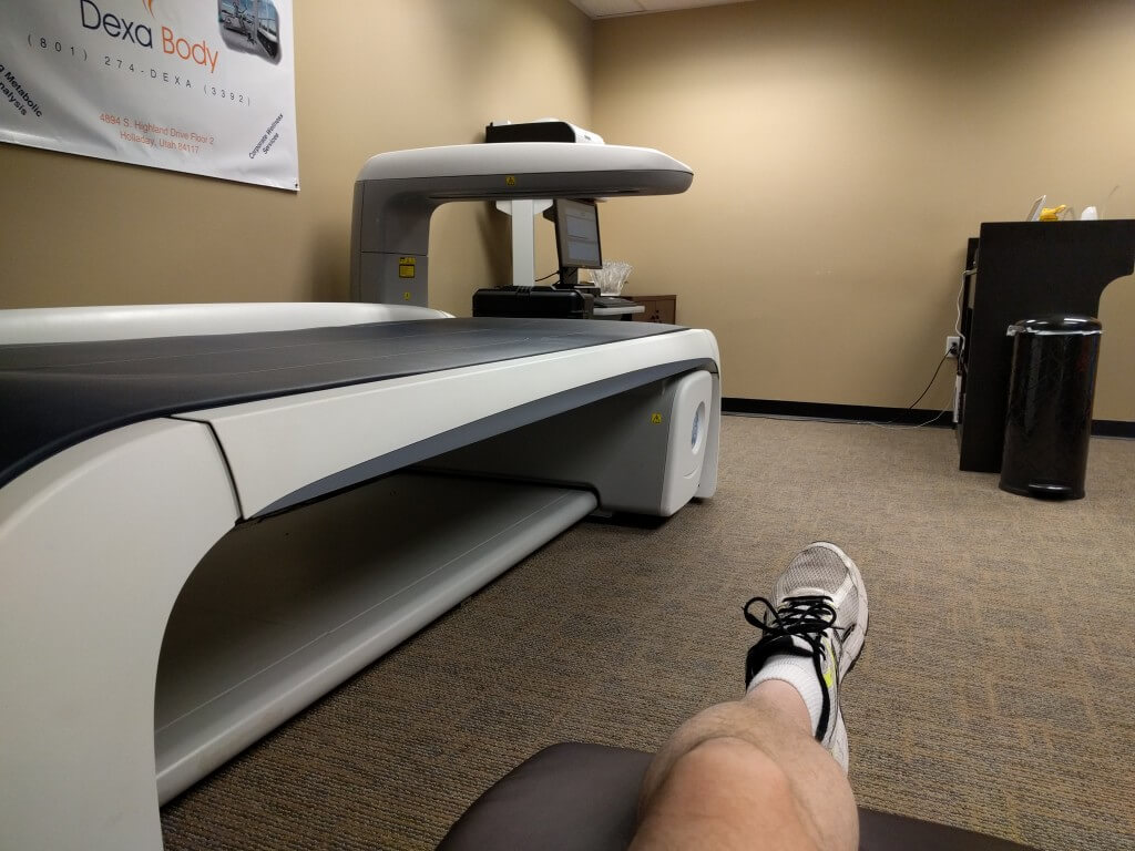 The DEXA scanner