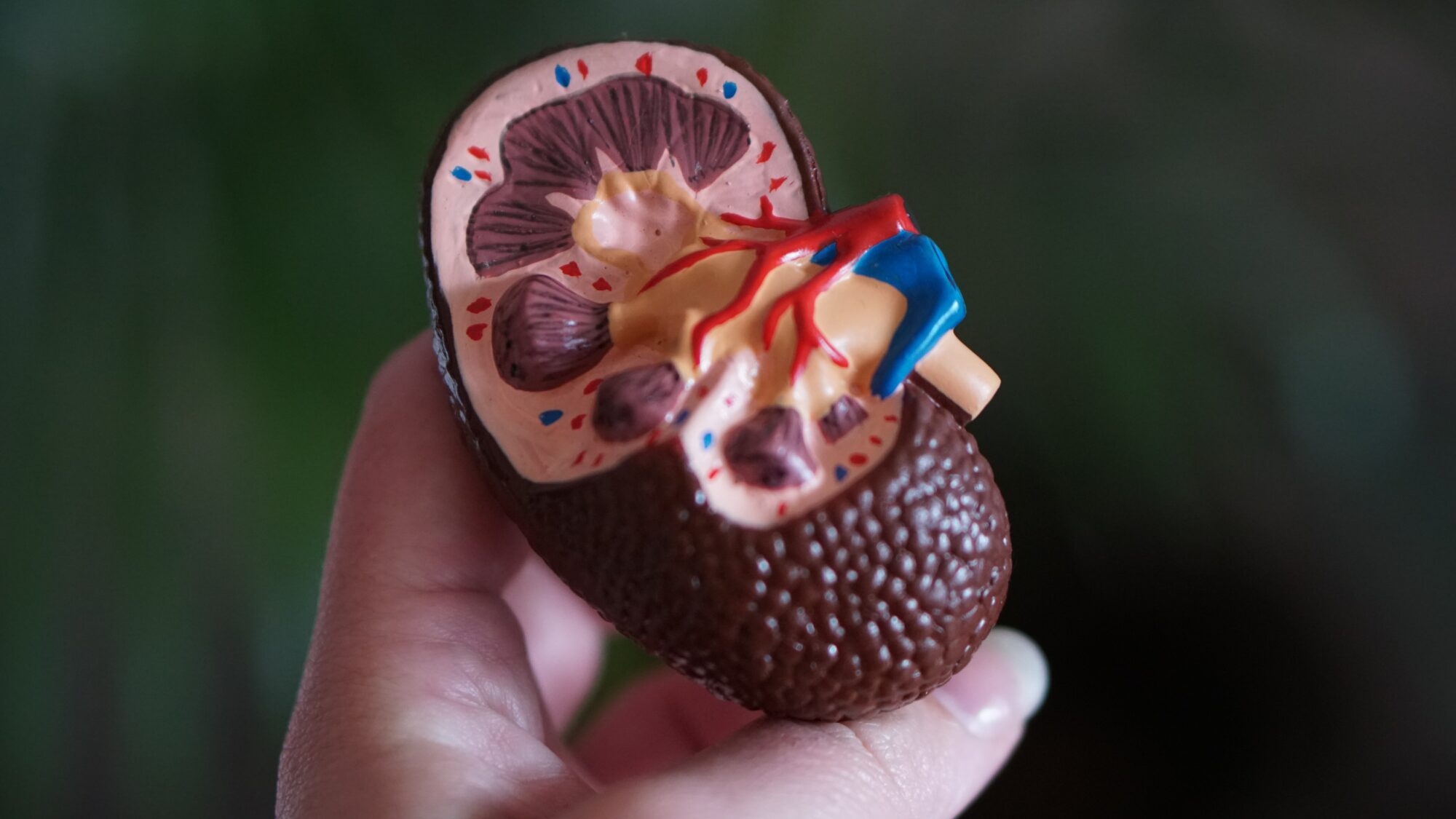 kidney medical model